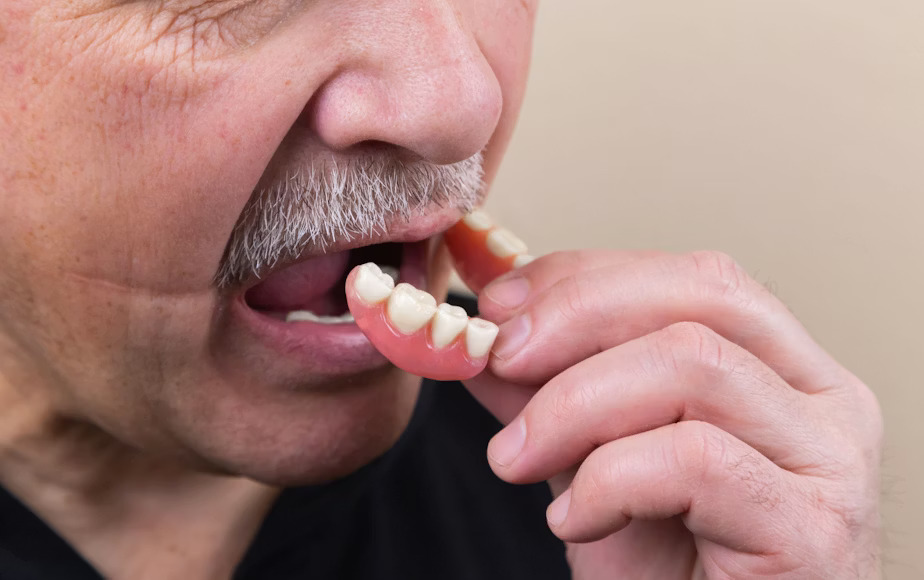Removable Dentures